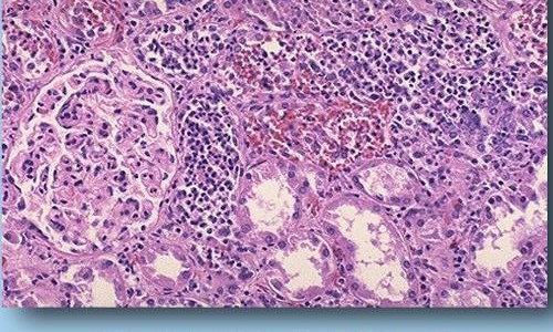 达克宁孕妇可以外用吗网 - 网站提供怀孕可以涂达克宁软膏吗小常识、达克宁孕妇可以外用吗女性